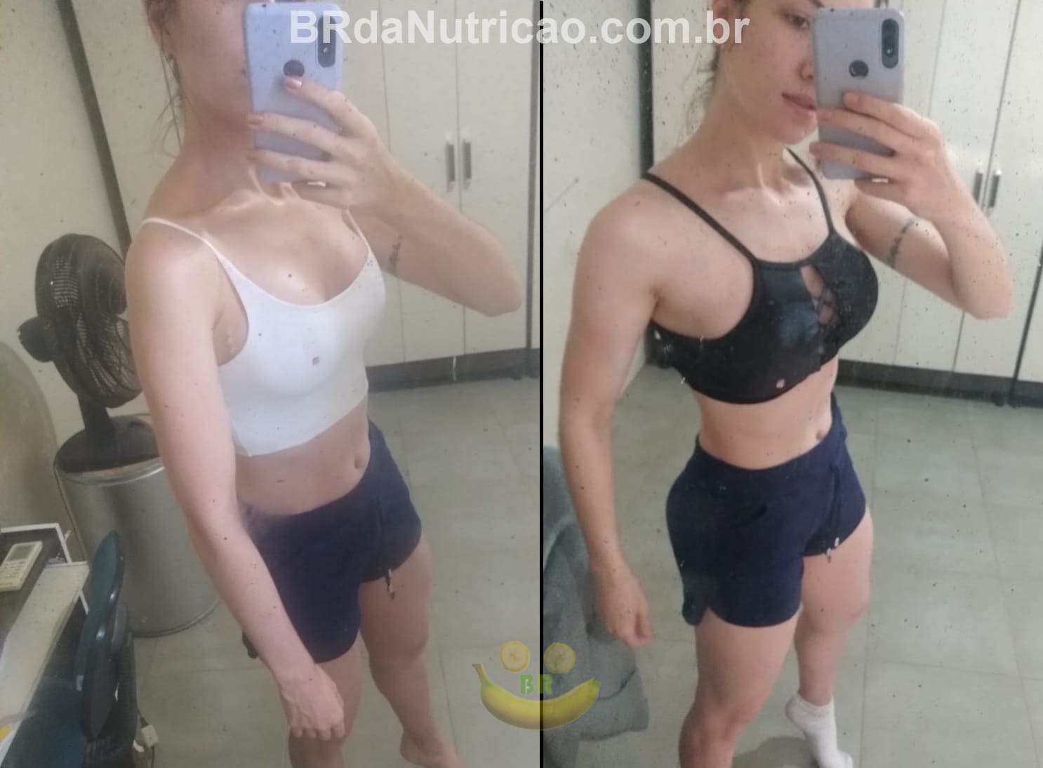 Talia – Resultado de recomposição corporal com acompanhamento nutricional