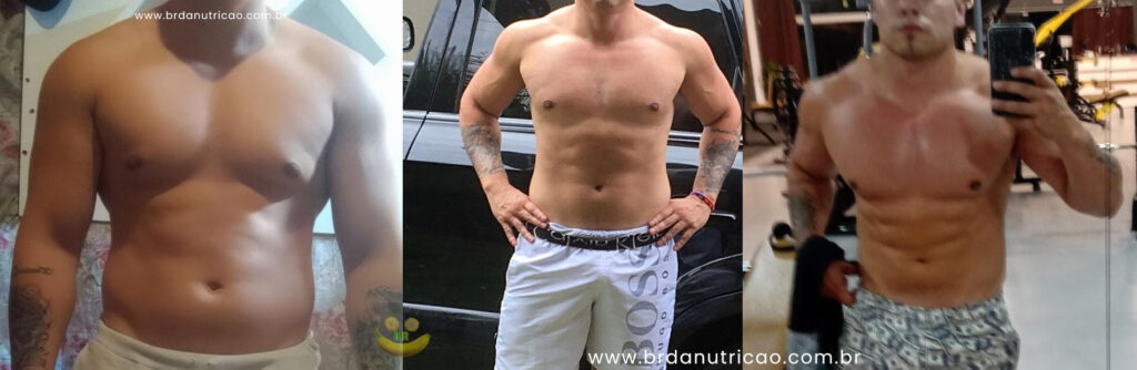 christofan lipomastia tratamento