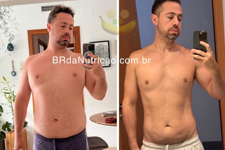 Antes e depois — William Esteves, aluno Dr. Bruno Rodrigo